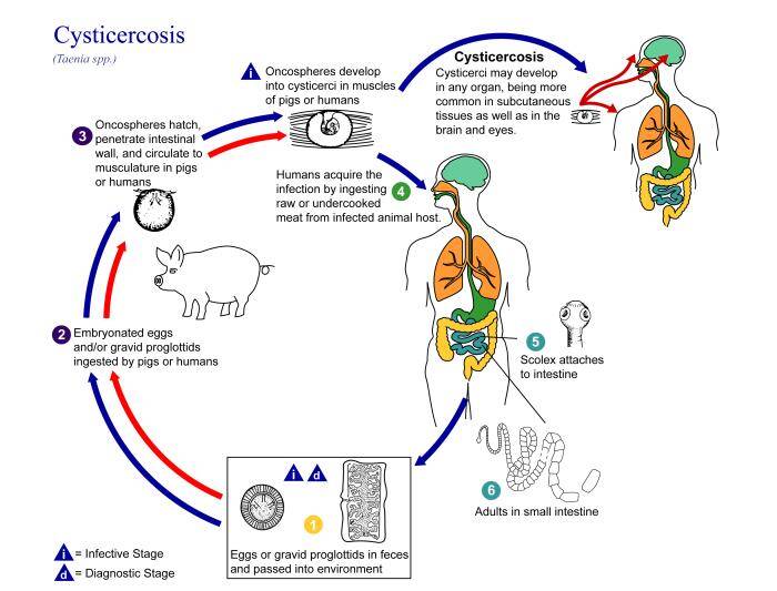 Infezione da Cysticercus Cellulosea