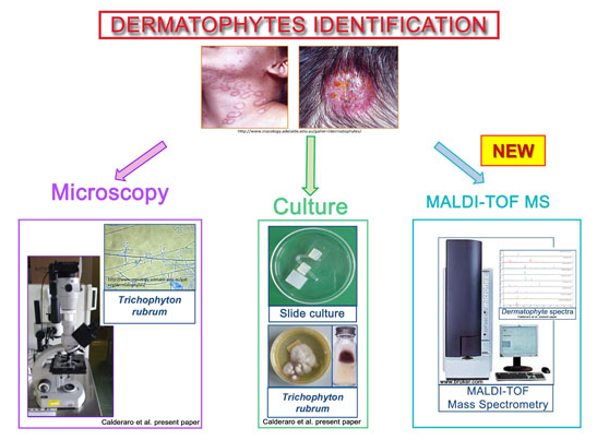 Identificazione delle infezioni da dermatofiti