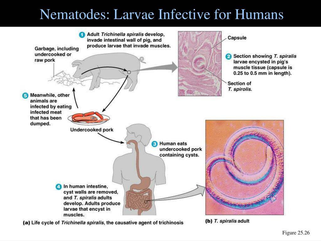 Larve di nematodi infettive per l'uomo