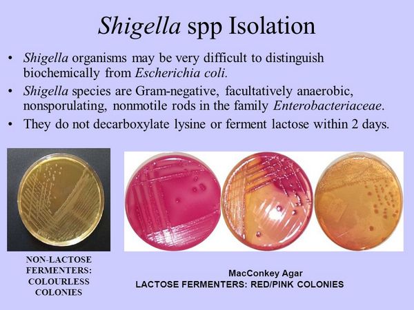 Specie di Shigella