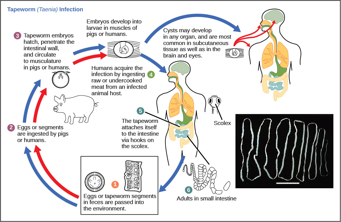 Infezione da Taenia saginata